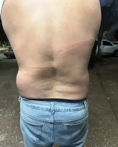 Los golpearon, les rociaron gas pimienta y les robaron la llave del auto: la pesadilla de una pareja en un boliche