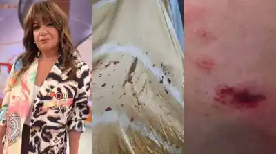 Andrea Taboada, mordida por un perro en la playa: la escalofriante reacción de los dueños que dejó a todos helados