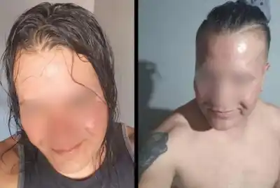 Un viaje desde Canadá terminó en pesadilla: la mujer que conoció a su novio virtual y sufrió una brutal agresión