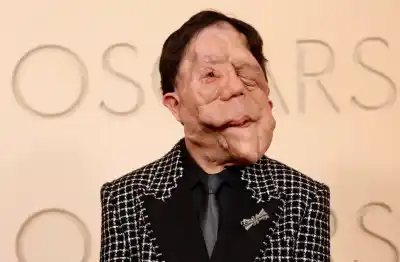 De la exclusión a la alfombra roja: la historia de resiliencia que marcó a un actor y visibiliza una enfermedad poco frecuente
