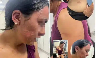 Agresión con agua hirviendo y golpiza: la versión de la acusada que contradice la denuncia