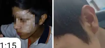 Jugaba con desodorante y encendedor en el aula: lo que le hizo a su compañero es escalofriante