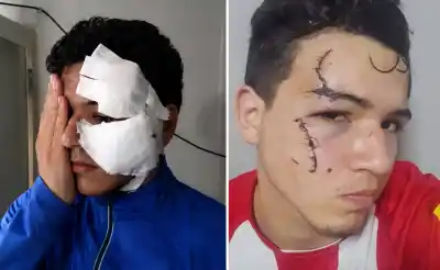 Atacaron a cuchilladas a un joven en Villa Obrera: lo que la Justicia no pudo evitar
