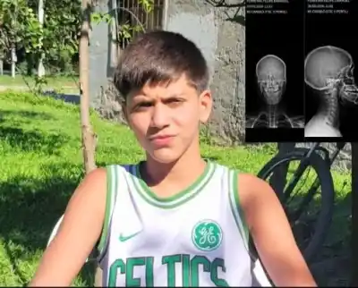 Fútbol violento: adolescente terminó con doble fractura de mandíbula tras separar una pelea en Alberdi