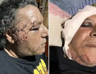 Salían a trabajar en bici y un grupo de más de ocho los atacó a cuchillazos: uno sigue en terapia
